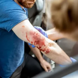 kasten yaralama davası avukatı izmir